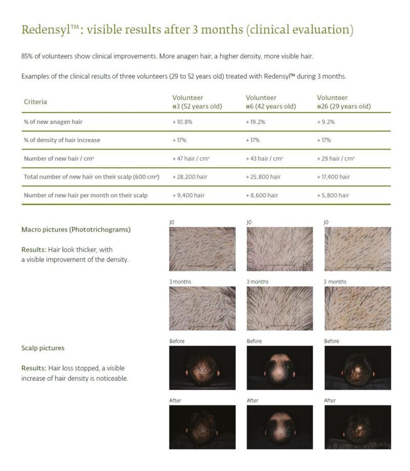 Sérum De Apoio Ao Crescimento Capilar Luxxul 50ml Com Ativos - Image 3