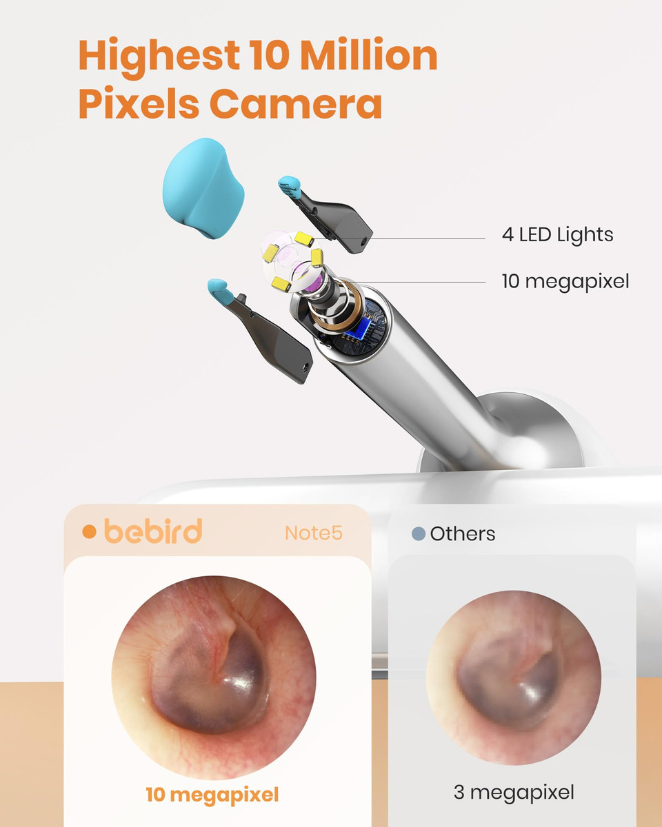 Kit De Ferramentas Para Remoção De Cera De Ouvido Bebird Ear - Imagem 2