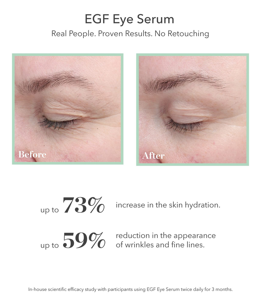 Sérum Para Os Olhos Bioeffect Egf W/ De-puffer Rollerball An - Imagem 2