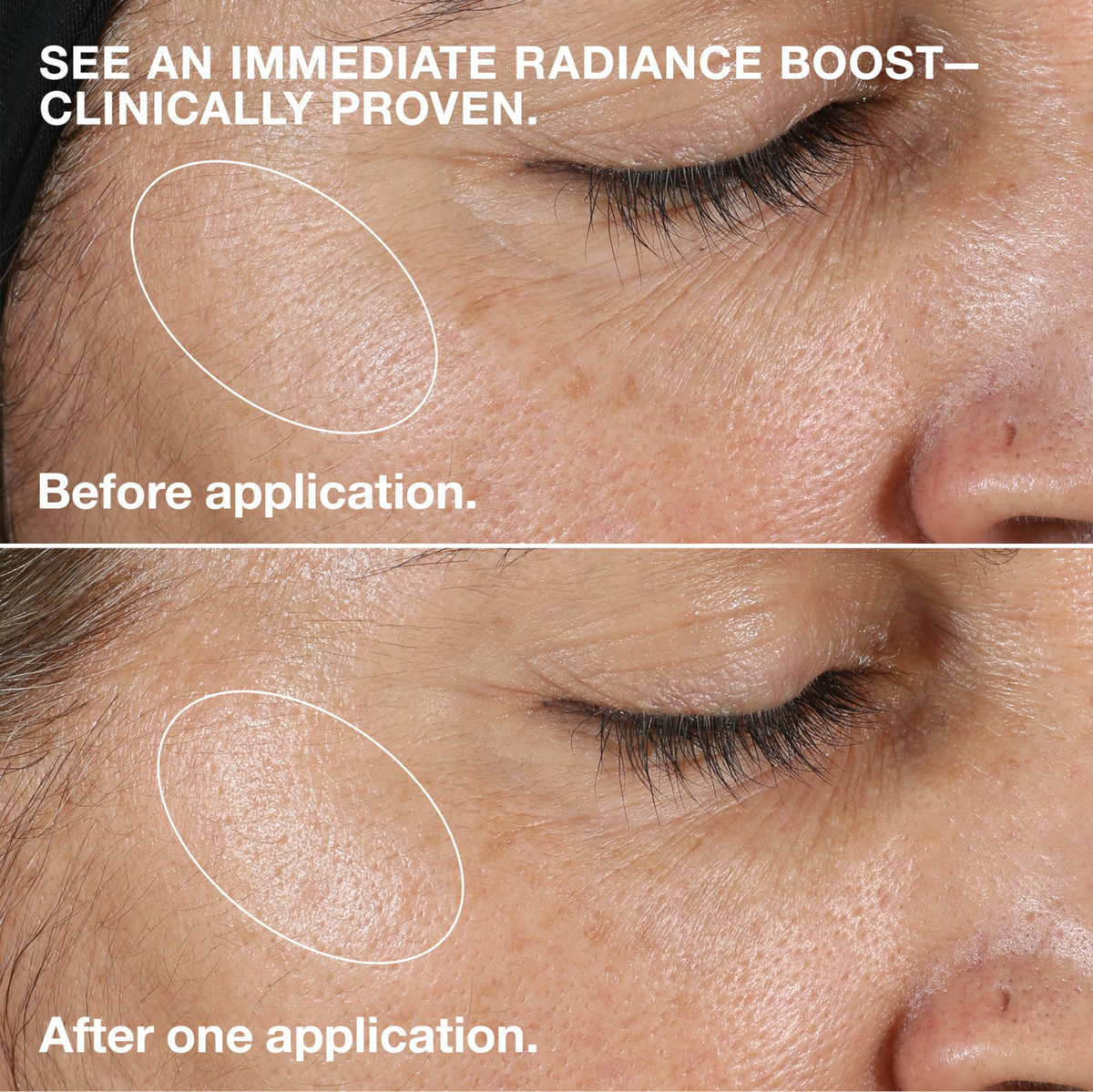 Esfoliante Facial Clinique Clarifying Lotion Dry Combination - Imagem 6