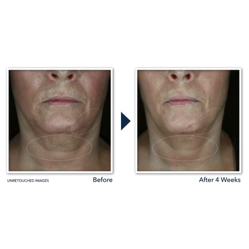 Creme De Pescoço Roc Lift & Tighten 1.198ml - Imagem 4