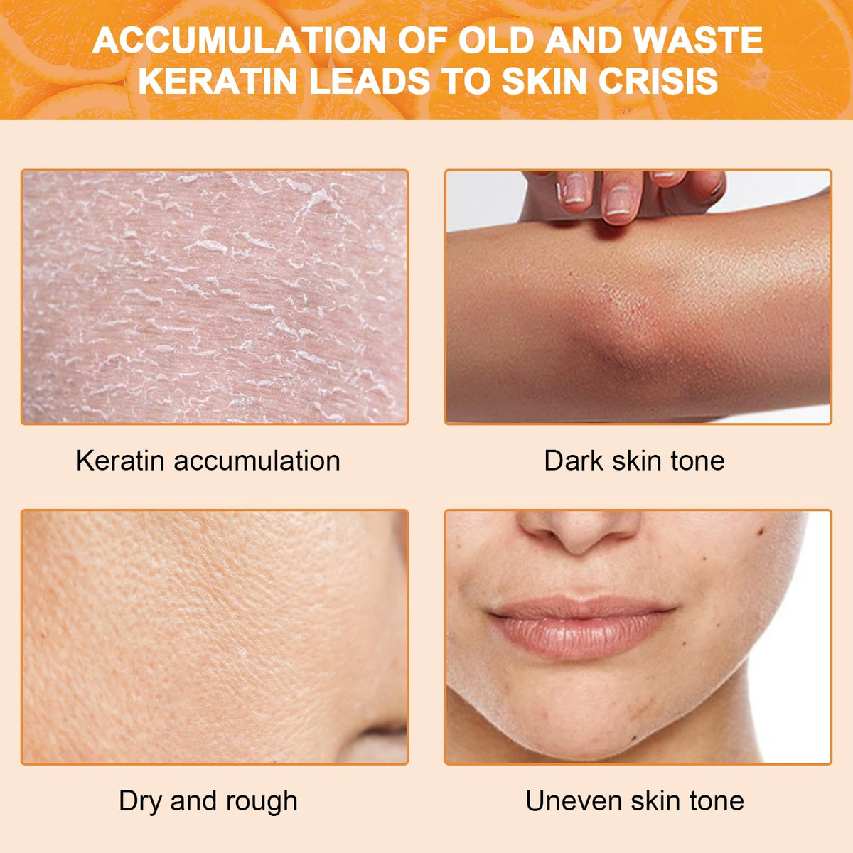 Esfoliante Em Gel Esfoliante Kanroadi Orange Face Body Skin, - Imagem 4