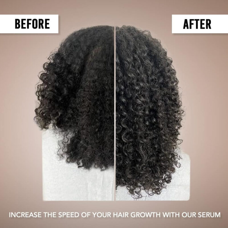 Sérum De Crescimento Capilar Amyla Cosmetics Para Mulheres 3 - Image 6