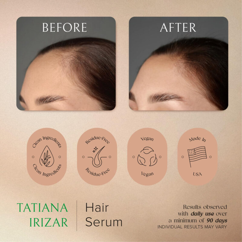 Sérum De Crescimento Capilar Tatiana Irizar Para Mulheres 30 - Image 3