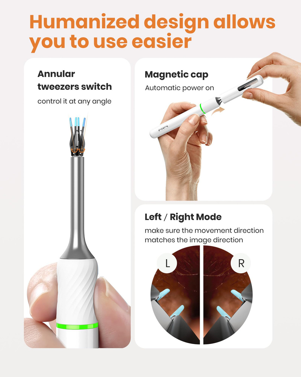 Kit De Ferramentas Para Remoção De Cera De Ouvido Bebird Ear - Imagem 5