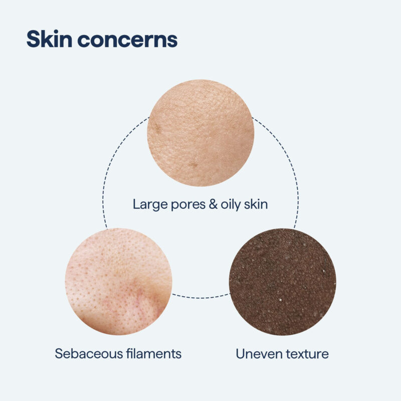 Pore Minimizer Remedy Science Com Retinol E Ácido Salicílico - Image 3