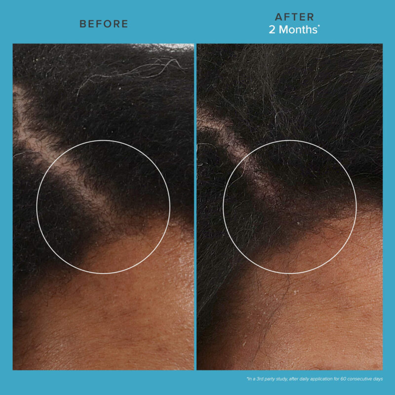 Tratamento Capilar Living Proof Scalp Care Revitalizing 75ml - Image 3