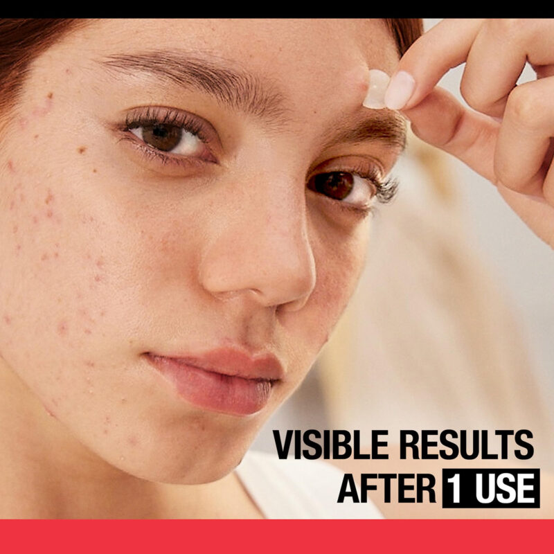Adesivos De Acne Para Espinhas Neutrogena Stuborn Acne Treat - Imagem 3