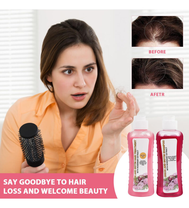 Conjunto De Cuidados Com O Cabelo: Cebola, Biotina, Alecrim, - Image 5