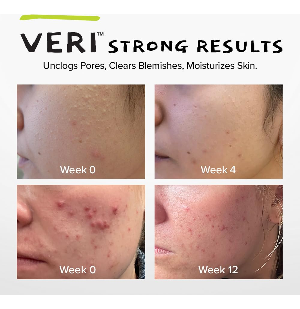 Skincare Veri Nitric Oxide + Ácido Salicílico Clear Skin Sys - Imagem 3