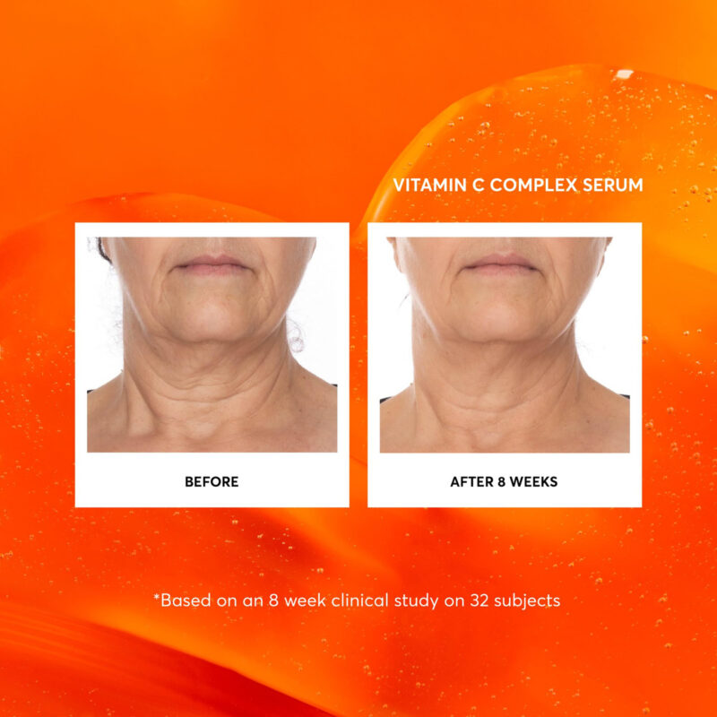 Sérum Naturium Complexo Facial De Vitamina C Com Ácido Hialu - Image 3