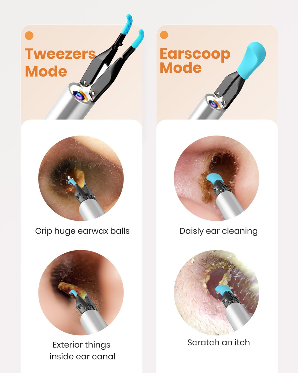 Kit De Ferramentas Para Remoção De Cera De Ouvido Bebird Ear - Imagem 3