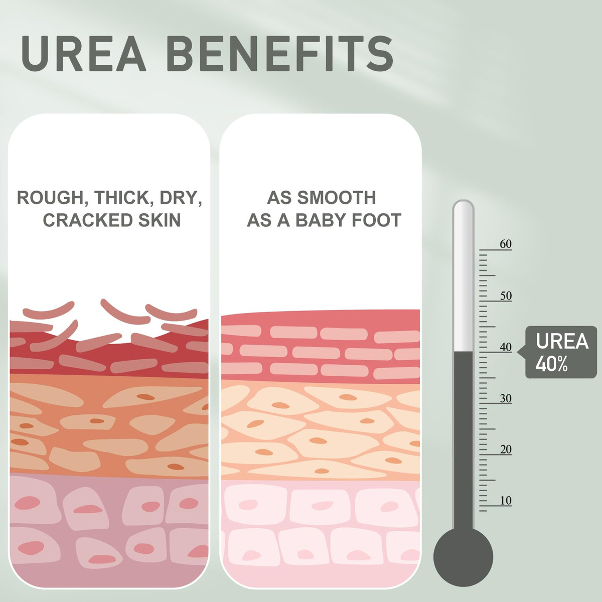 Creme De Ureia Mouriven 40% Para Pele Seca E Rachada, 2 Paco - Imagem 3