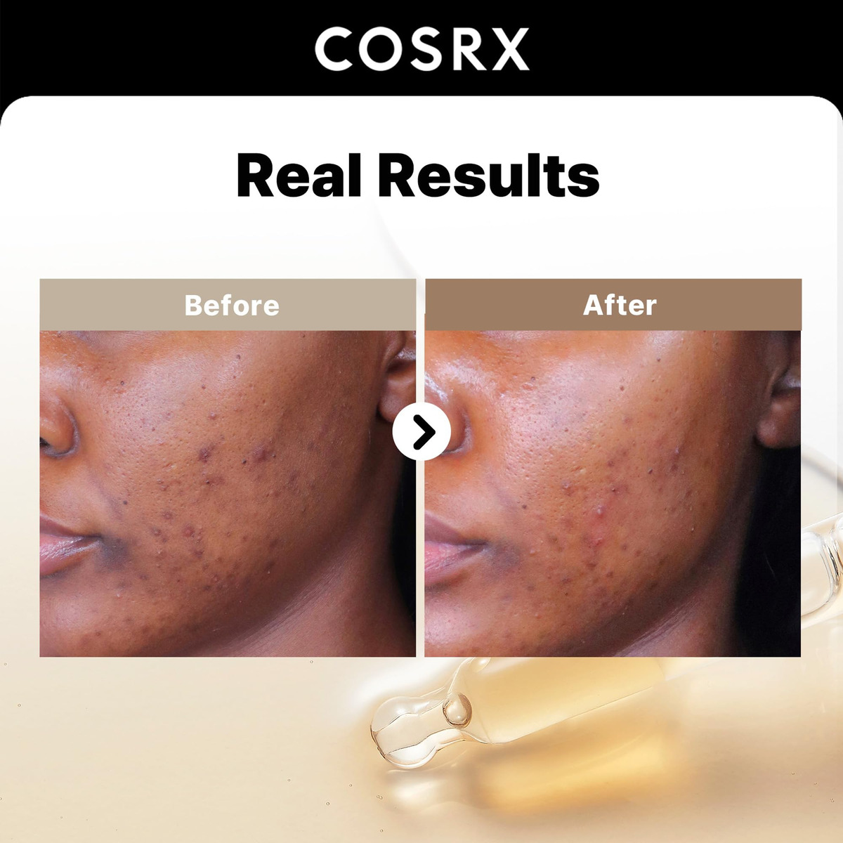 Sérum Cosrx Alpha Arbutin 2% Para Tratamento De Descoloração - Imagem 2