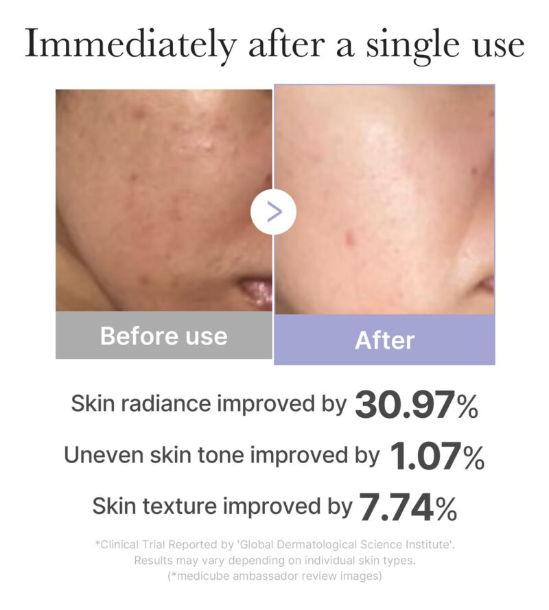 Ferramenta Para Cuidados Com A Pele Facial Medicube Mini Boo - Image 3