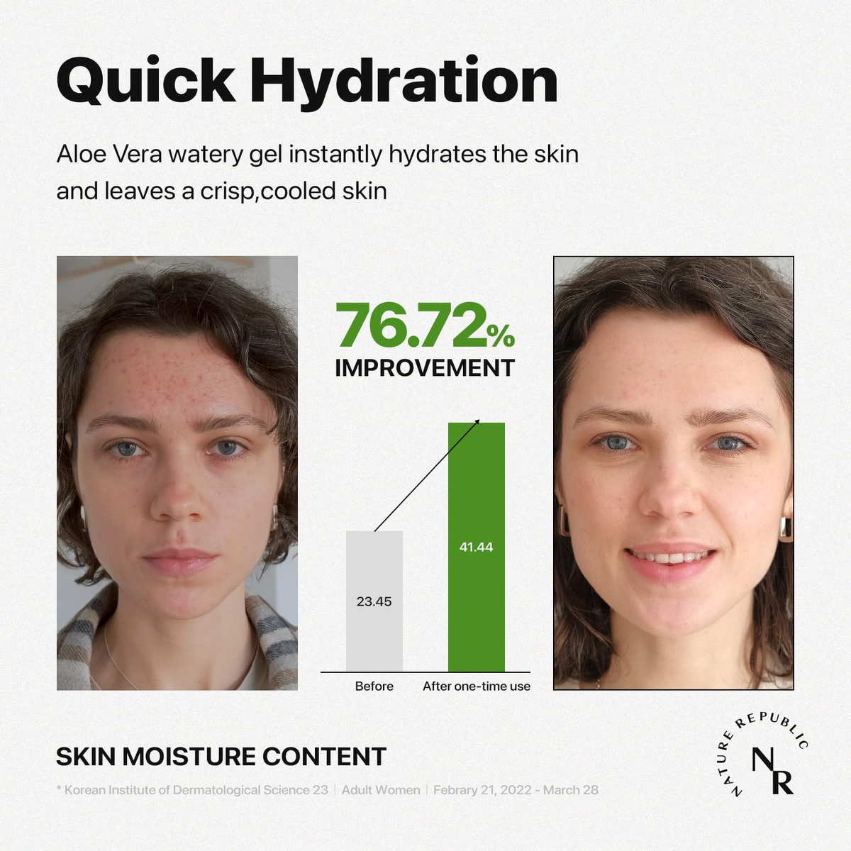 Gel De Aloe Vera Nature Republic Hidratante Suavizante 310ml - Imagem 5