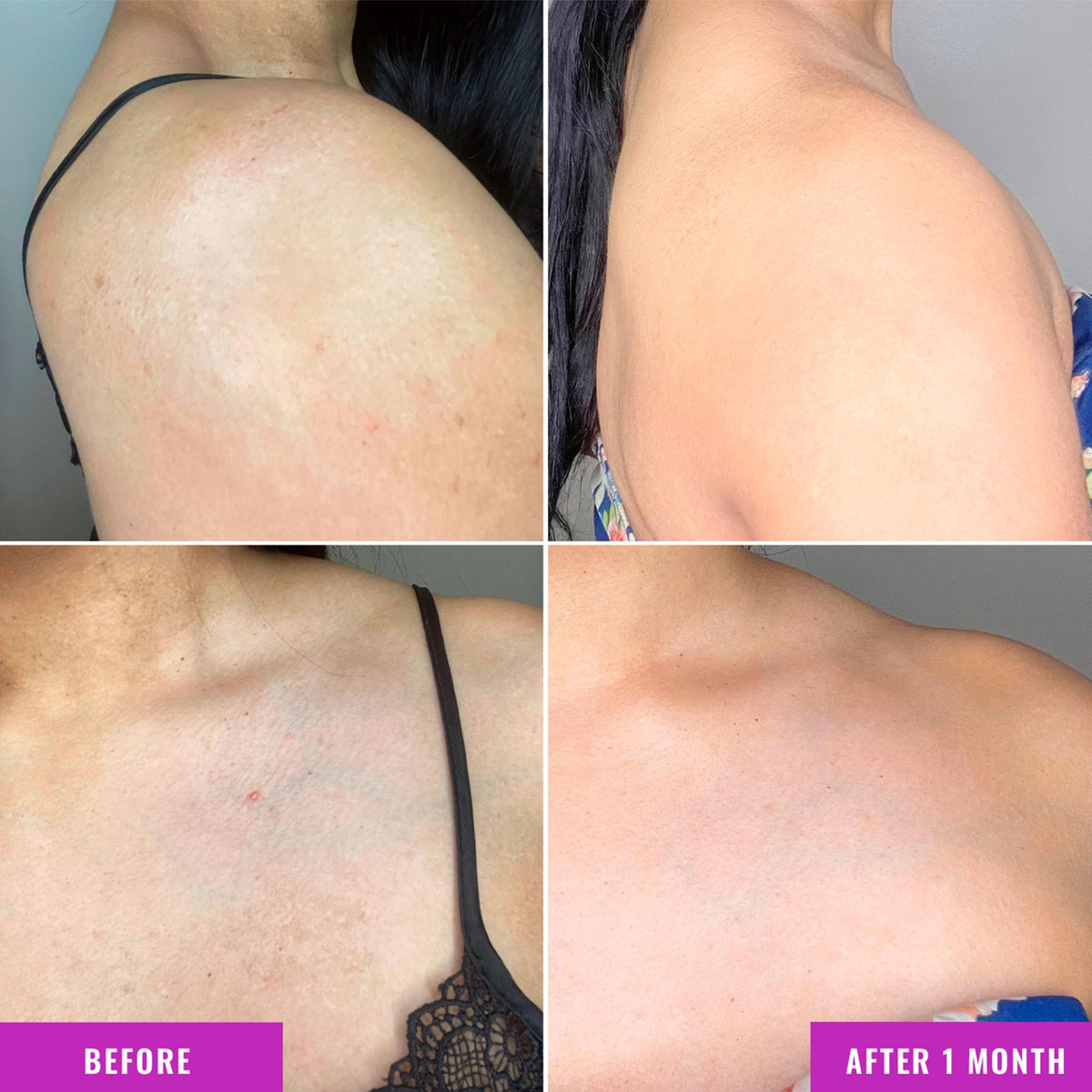 Creme De Tratamento Corporal Good Molecules Descolation Corr - Imagem 4