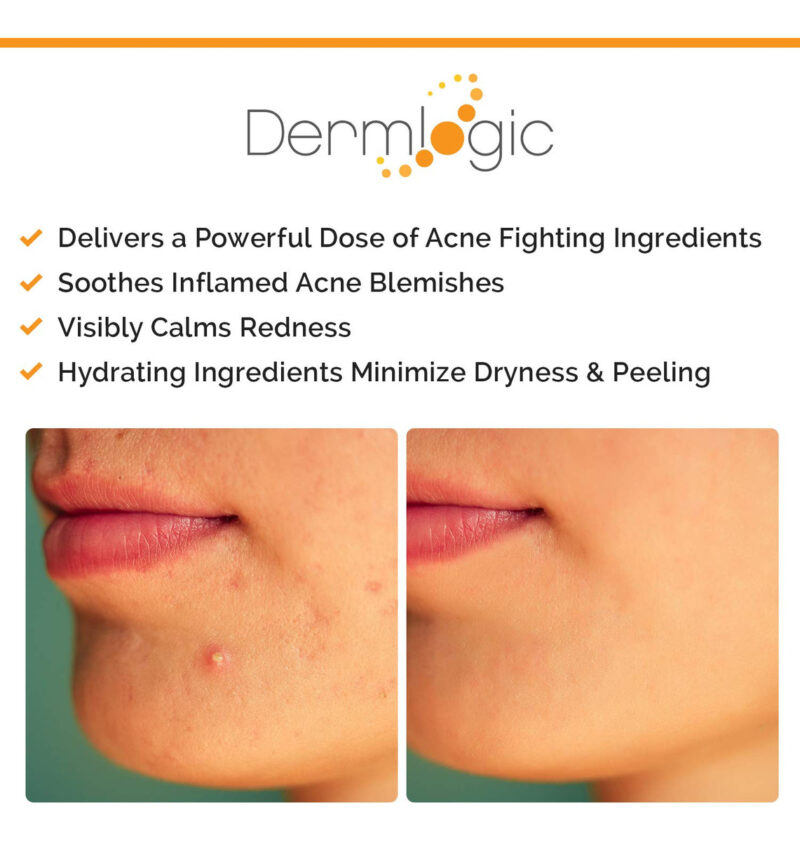 Tratamento De Manchas De Acne Dermlogic Overnight Whitehead - Image 6