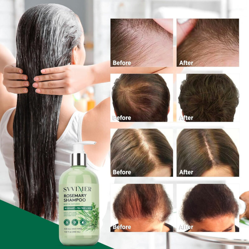 Shampoo Para Crescimento Capilar De Alecrim: Espessamento E - Image 2