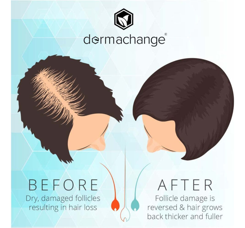 Shampoo Para Crescimento Capilar Dermachange Volumizing Sulf - Image 5