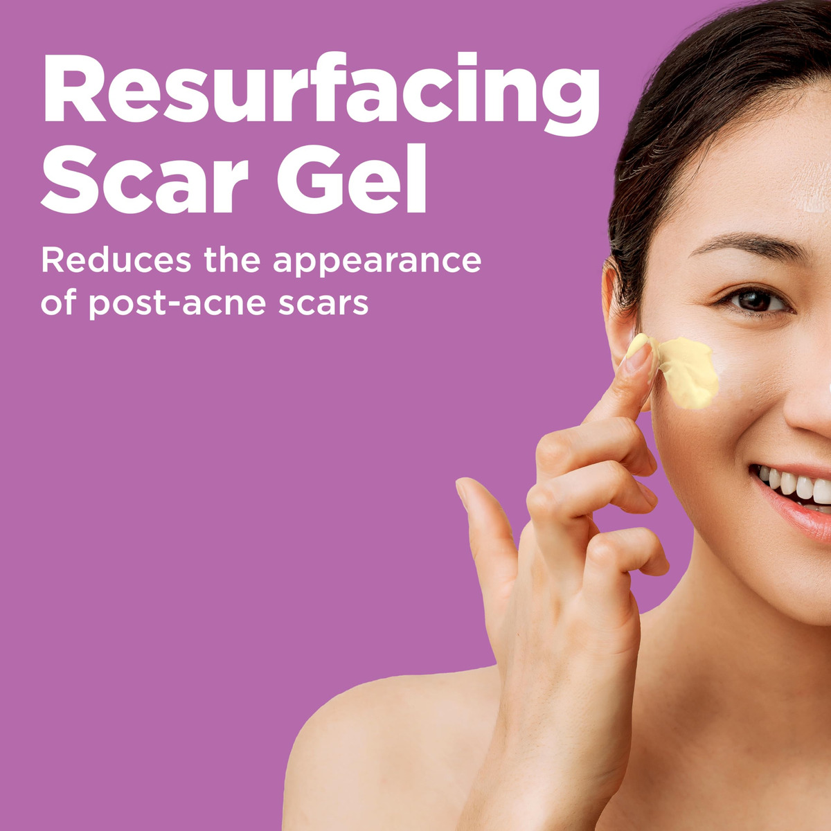 Gel De Tratamento Para Manchas De Cicatrizes De Acne Differi - Imagem 3