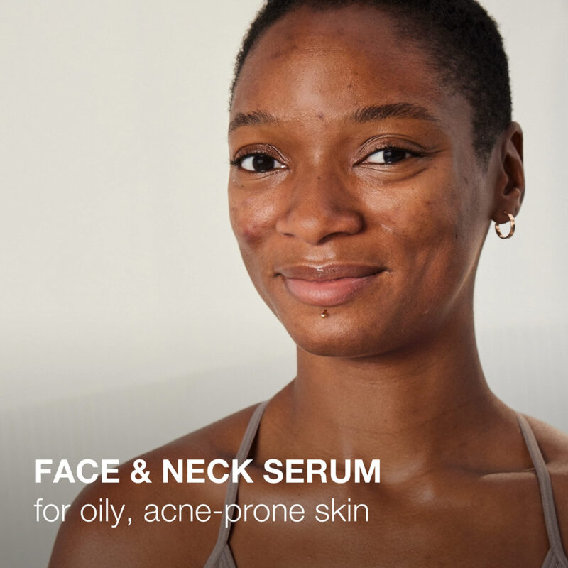 Sérum Neutrogena Stubborn Texture Resurfacing 30 Ml Com Niac - Image 3