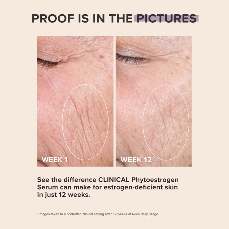 Sérum Facial Paula's Choice Clinical Fitoestrogen Elasticity - Image 3