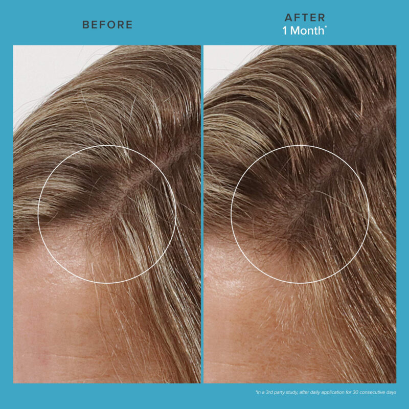 Tratamento Capilar Living Proof Scalp Care Revitalizing 75ml - Image 2