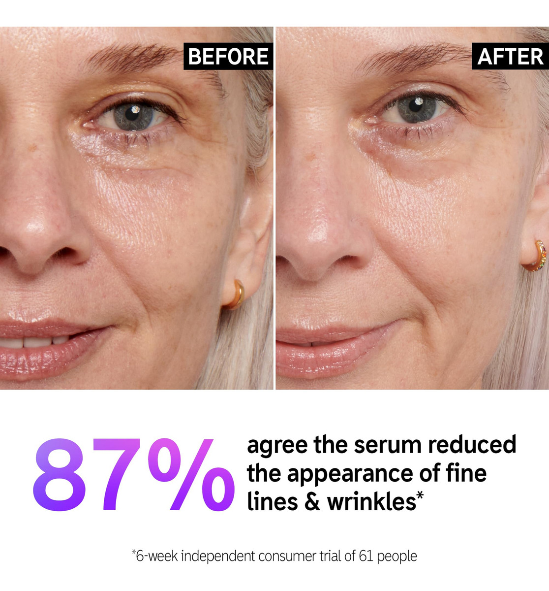 Sérum The Inkey List 1% De Retinol De Liberação Lenta 30 Ml - Imagem 3