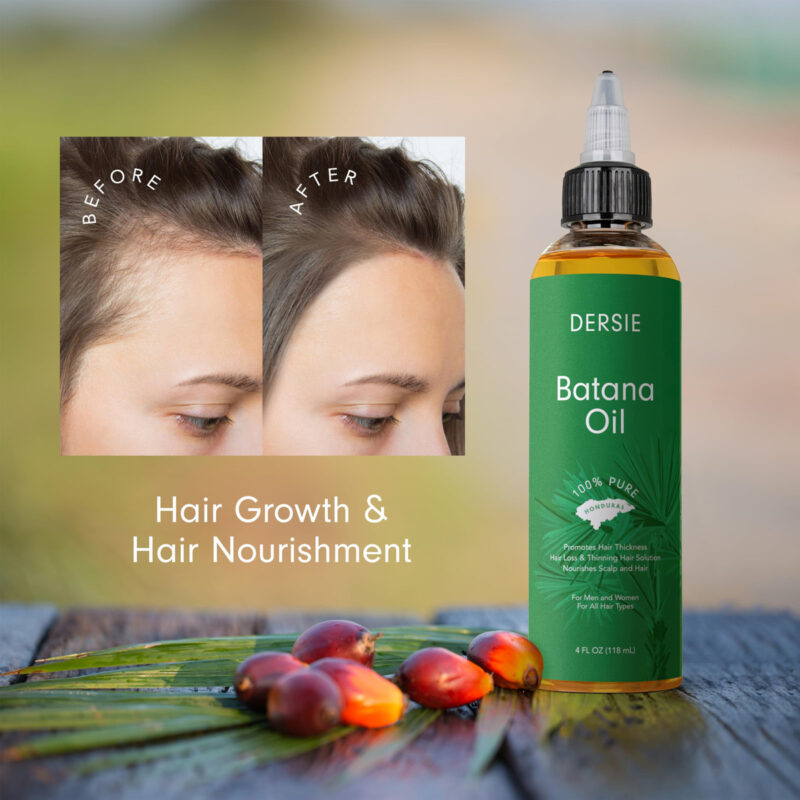 Dersie De Óleo De Batana Para Crescimento De Cabelo 100% Pur - Image 8