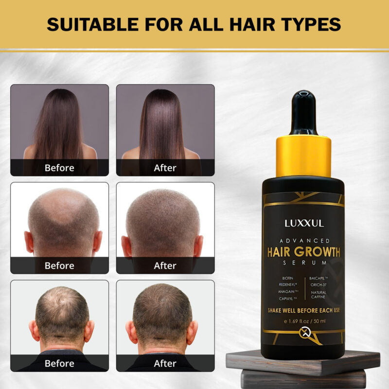 Sérum De Apoio Ao Crescimento Capilar Luxxul 50ml Com Ativos - Image 4