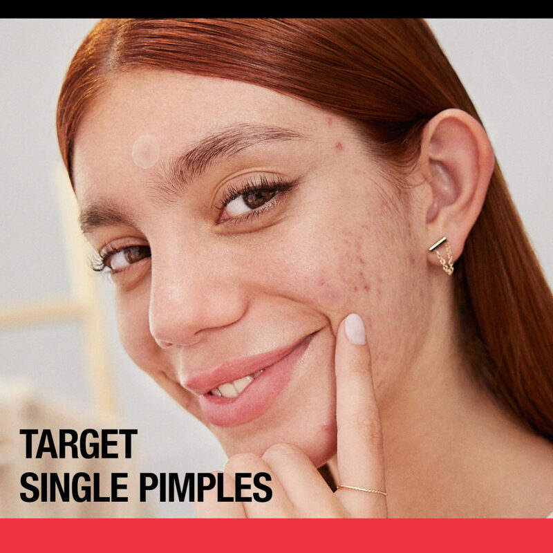 Adesivos De Acne Para Espinhas Neutrogena Stuborn Acne Treat - Imagem 5