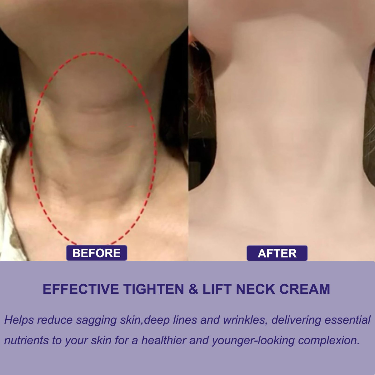 Creme Firmador De Pescoço Cnyyds Tighten & Lift Para Todos O - Imagem 4