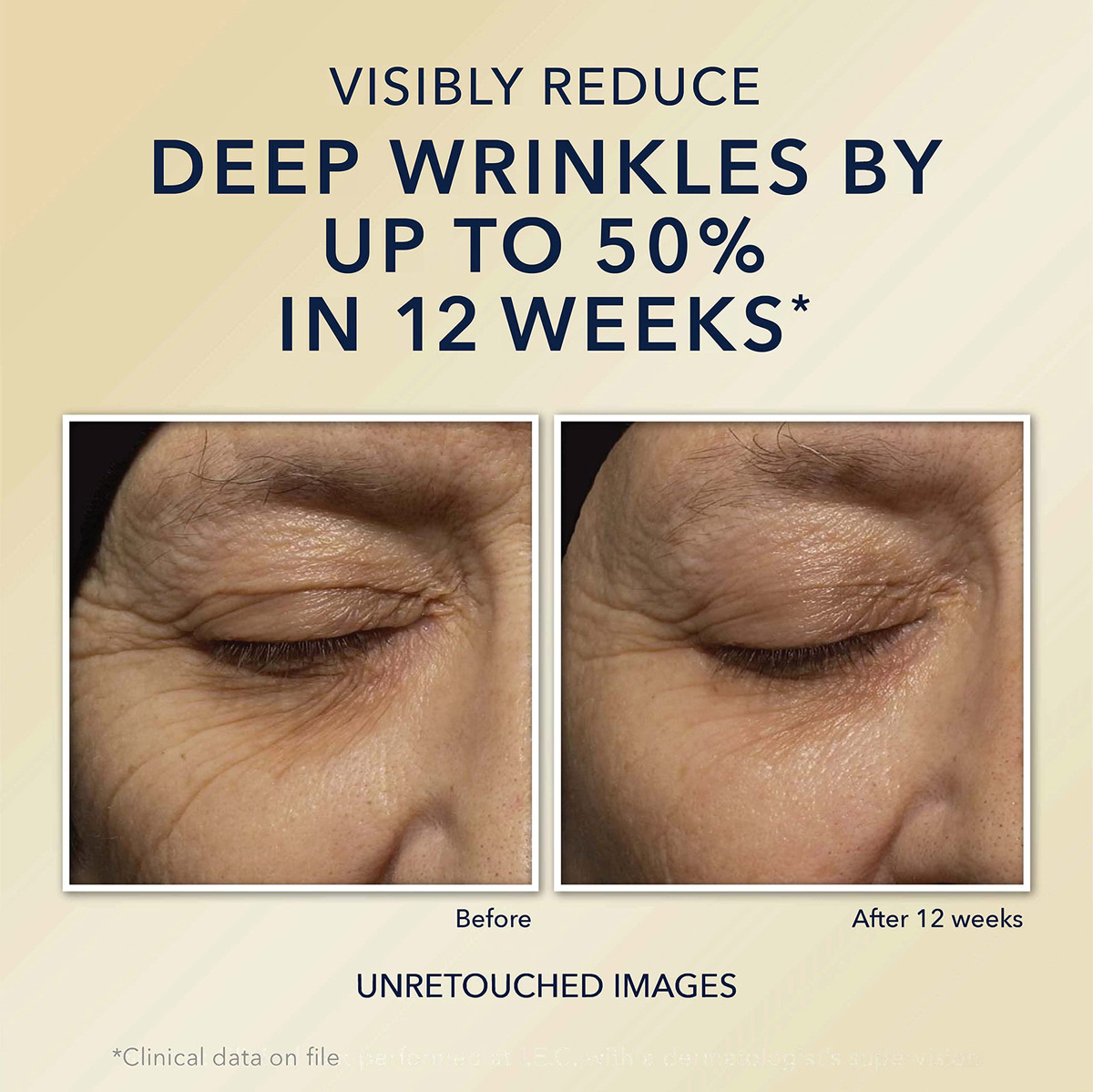 Creme Hidratante Roc Retinol Correxion Rugas Profundas - Imagem 4