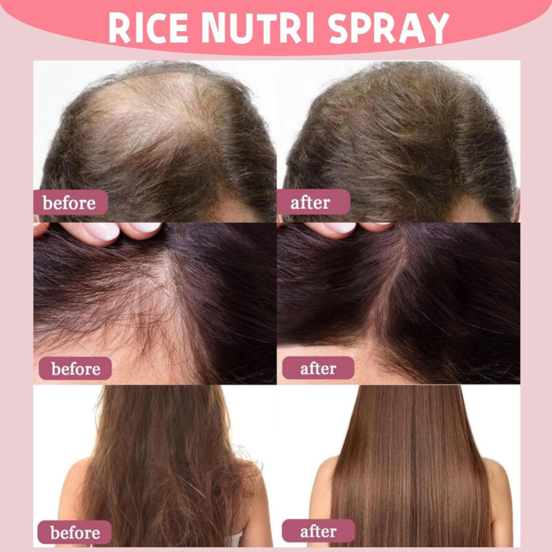 Spray De Crescimento Capilar Rottipe Rice Nutri Com Biotina - Image 7