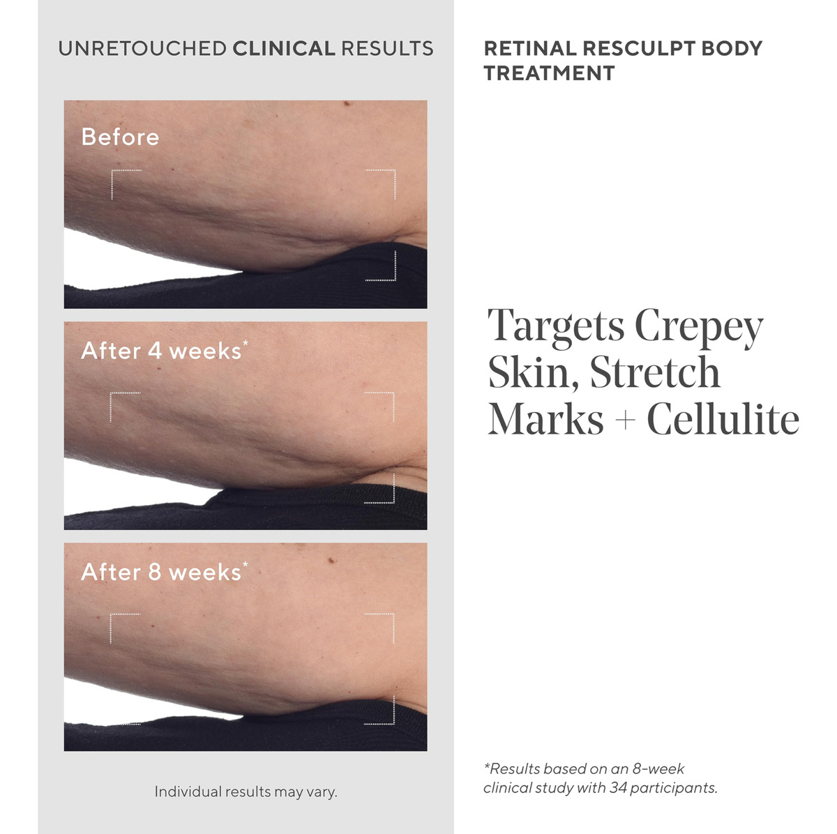 Creme De Tratamento Corporal Murad Retinal Resculpt 150ml - Imagem 6