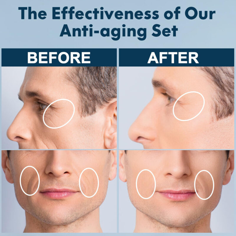 Conjunto De Cuidados Com A Pele Fulllight Tech Anti Aging Pa - Image 6