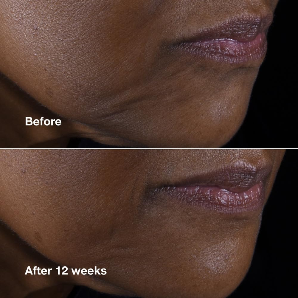 Creme Clinique Smart Clinique Clinique Clinique Lifting Face - Imagem 3