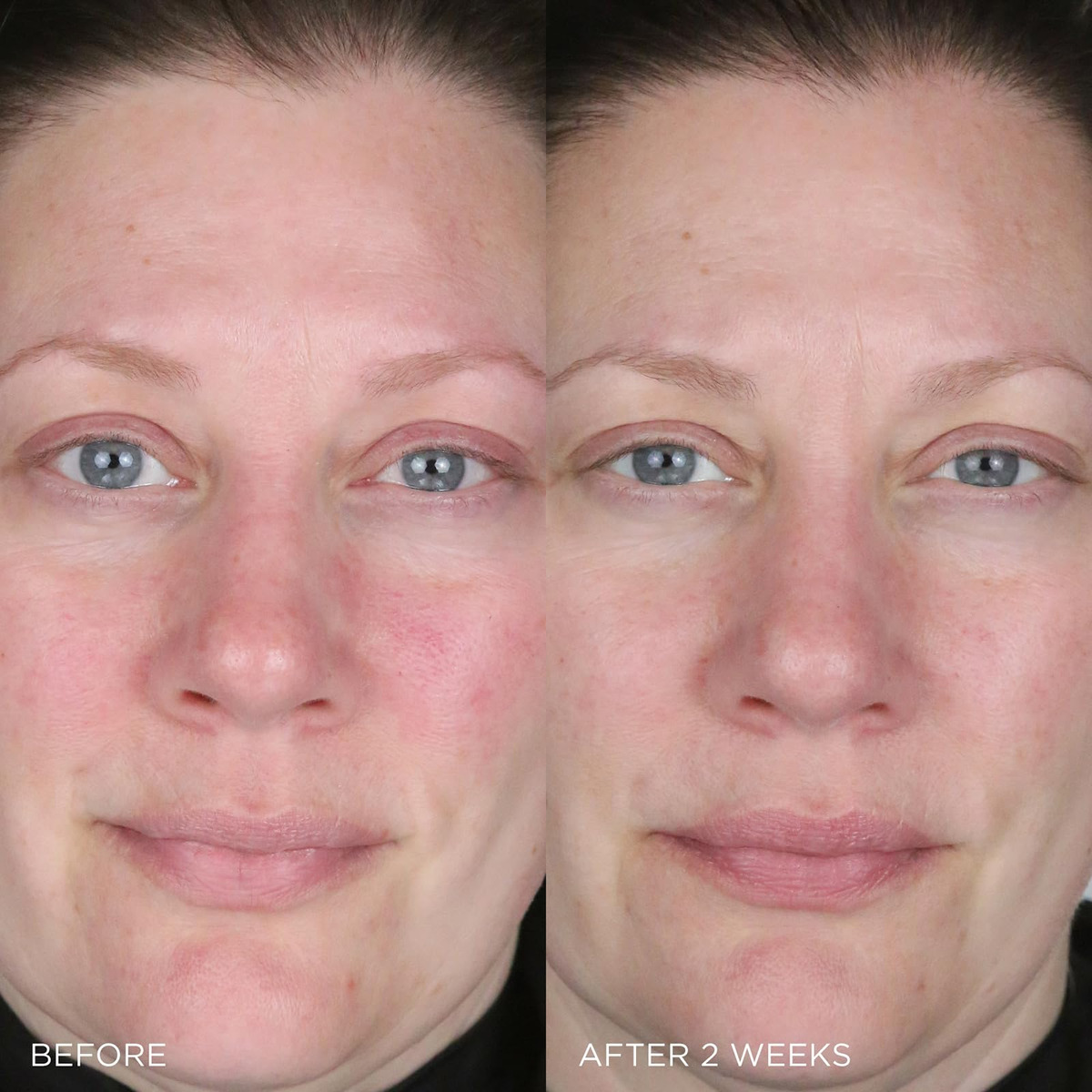 Creme Hidratante Tatcha Indigo Calmante Para Eczema 50ml - Imagem 6
