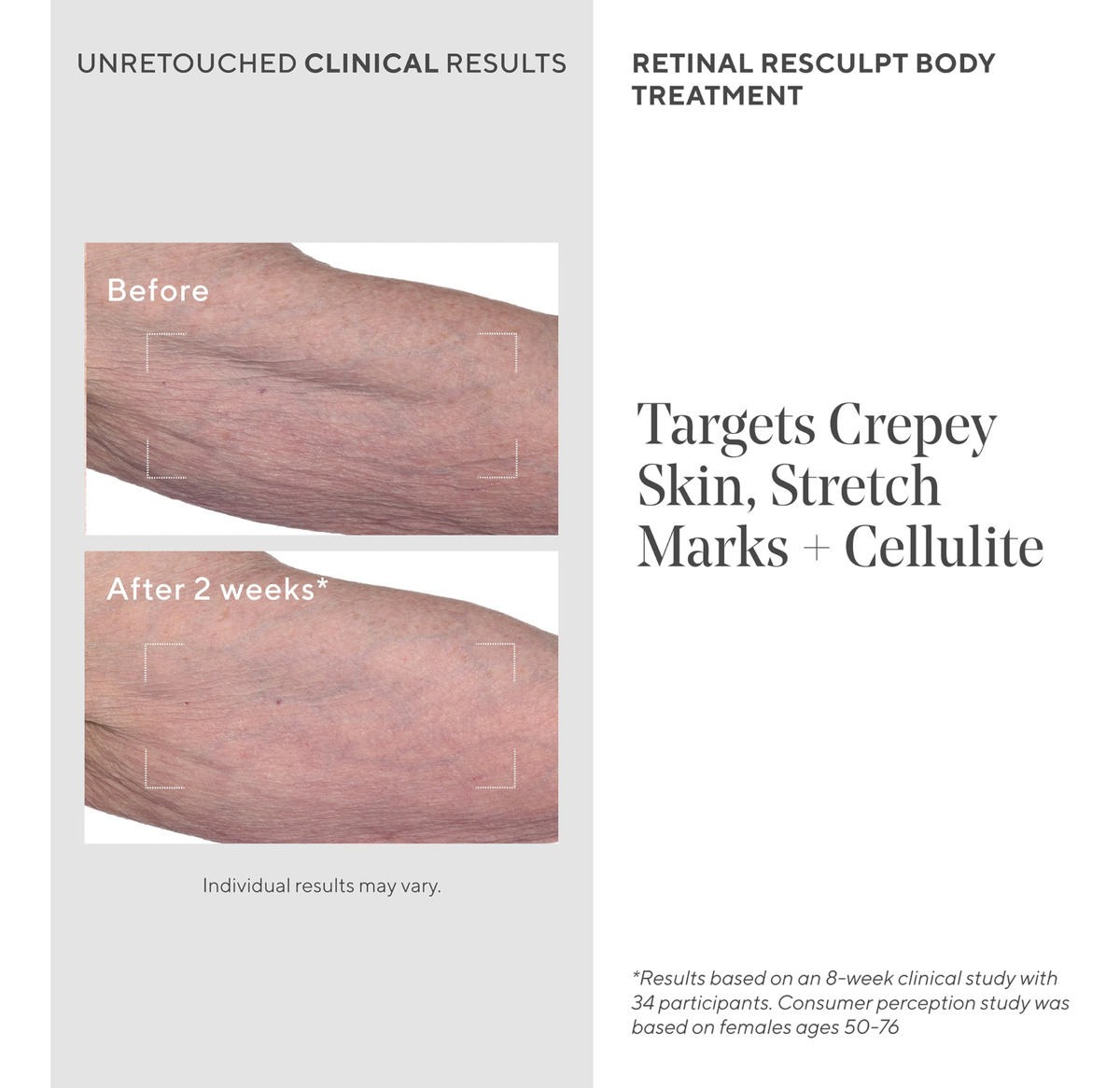 Creme De Tratamento Corporal Murad Retinal Resculpt 150ml - Imagem 3