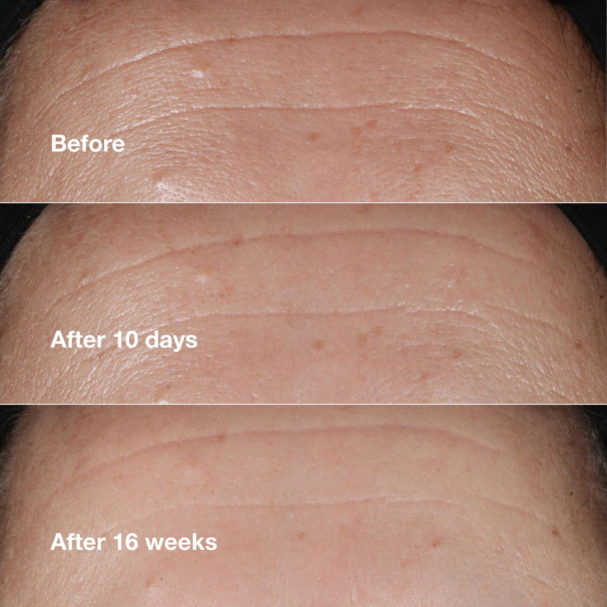 Sérum Clinique Smart Clinique Clinique Repair Rugas 100ml - Imagem 4