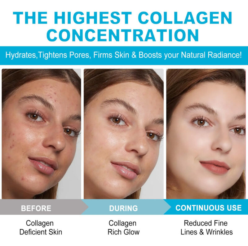 Máscara Facial Xsvseie Collagen Deep Anti Rugas Hydrogel - Image 5