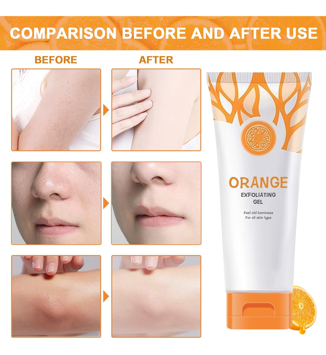 Esfoliante Em Gel Esfoliante Kanroadi Orange Face Body Skin, - Imagem 6