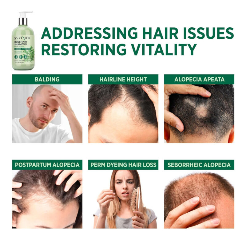 Shampoo Para Crescimento Capilar De Alecrim: Espessamento E - Image 4