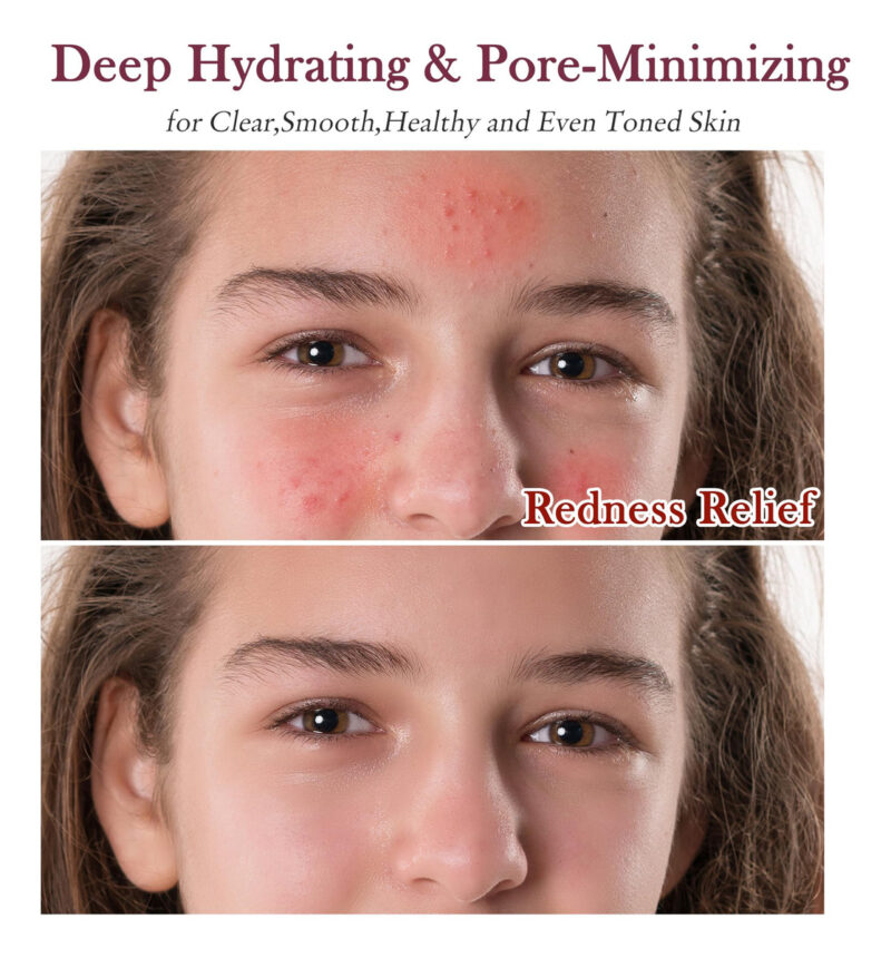 Conjunto De Cuidados Com A Pele Gebeaty Pore Minimizer Para - Image 2