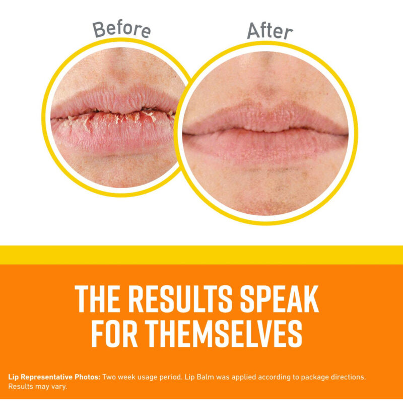 Bálsamo Labial O'keeffe's Lip Repair Spf 35, Pacote Com 3 - Image 2