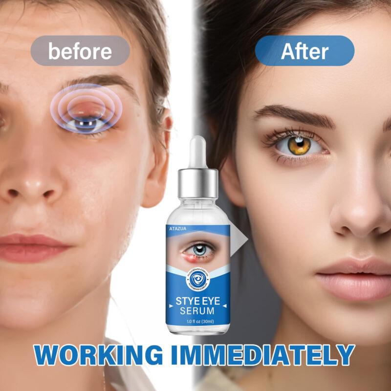 Sérum De Tratamento Ocular Atazua Sye, Limpa Cílios E Olhos - Image 6