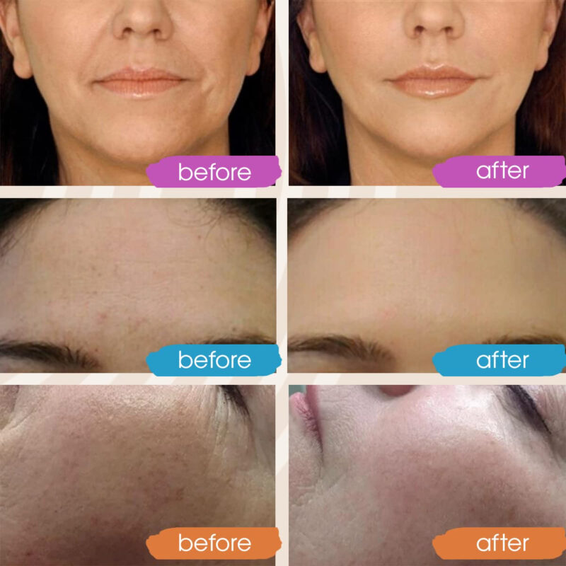 Conjunto De Sérum Gleow Retinol, Vitamina C E Ácido Hialurôn - Image 4