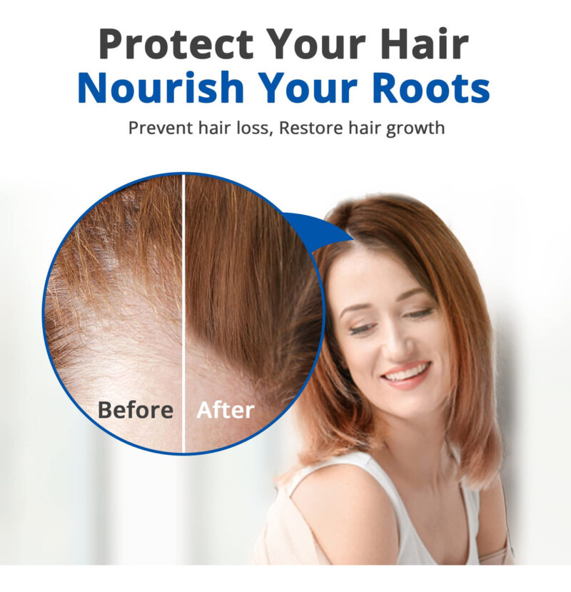 Sérum De Cabelo Hairmetto Para Queda E Crescimento De Cabelo - Image 7
