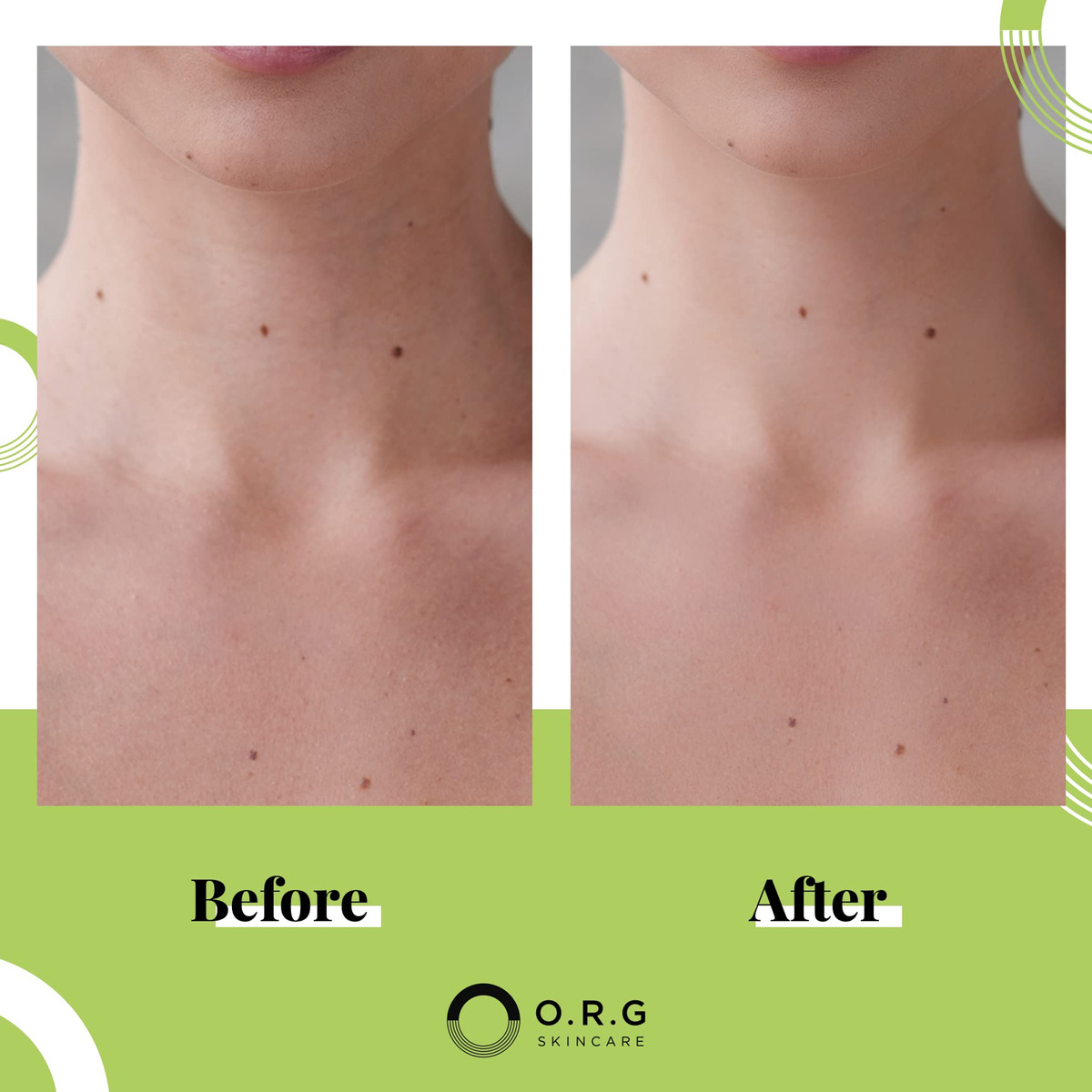 Esfoliante Em Gel Profundo Body Scrub O.r.g. Skincare 180ml - Imagem 3